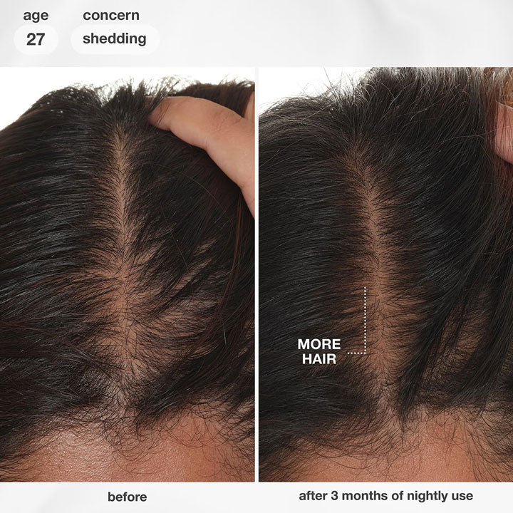 K18 FutureIQ Biomimetic Hair Longevity Serum 90ml - KOOS • alles voor je haar